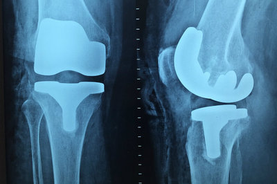 orthopedic EHR - x-ray